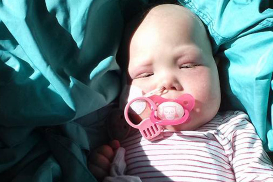 Die kleine Yuna Josefina musste in ihrem jungen Leben schon viel über sich ergehen lassen.