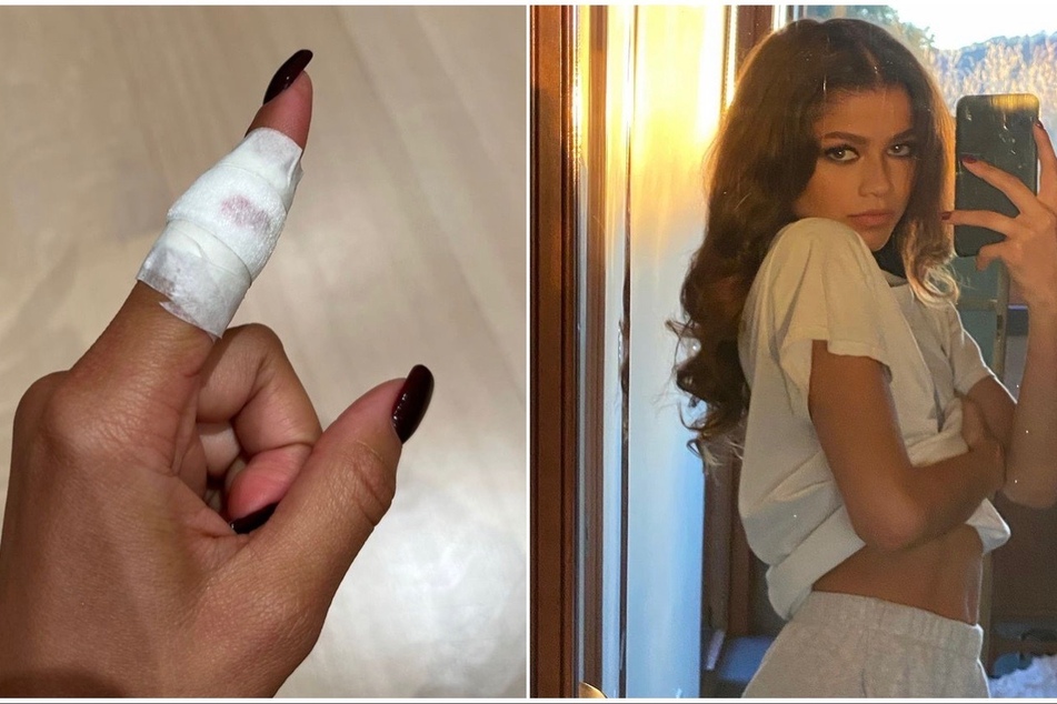 Zendaya had to take a trip to the emergency room after she injured herself in the kitchen.