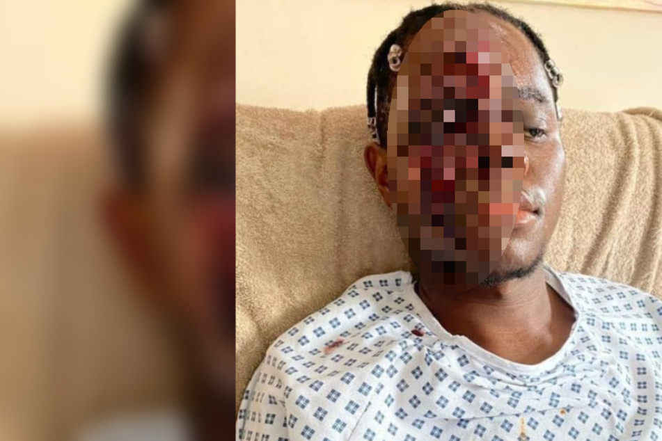 Der 21-Jährige erlitt durch den Angriff schwere Verletzungen.