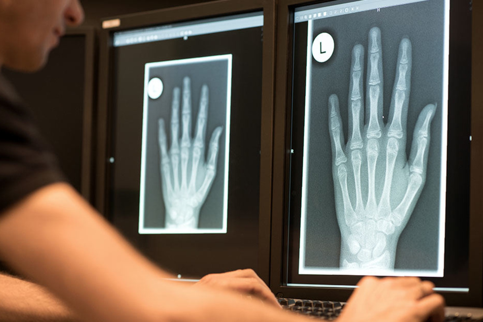 Ein Radiologe schaut sich im Röntgenbild die linke Hand eines 13-Jährigen an.
