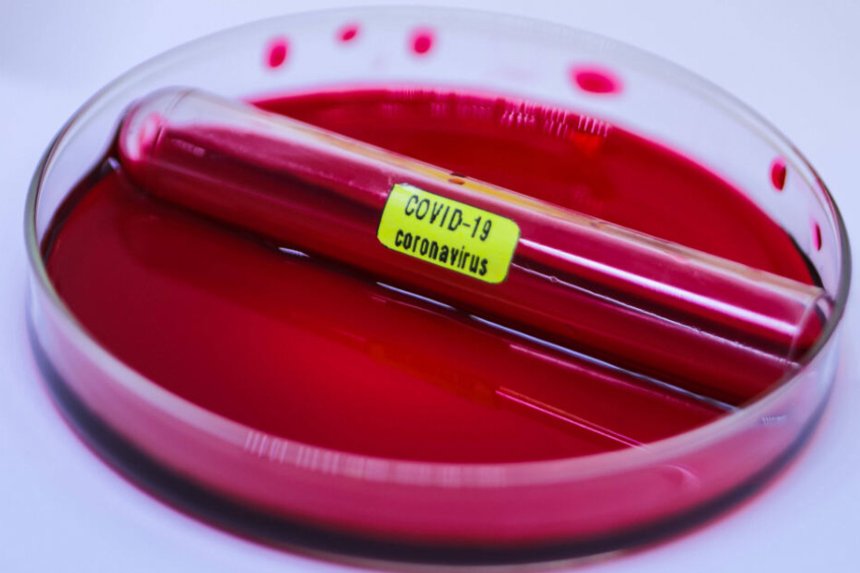 Klarheit nach rund drei Stunden: Der molekularbiologische Test zum Nachweis des Sars-CoV-2-Virus schlägt schon bei vier einzelnen Viren an.