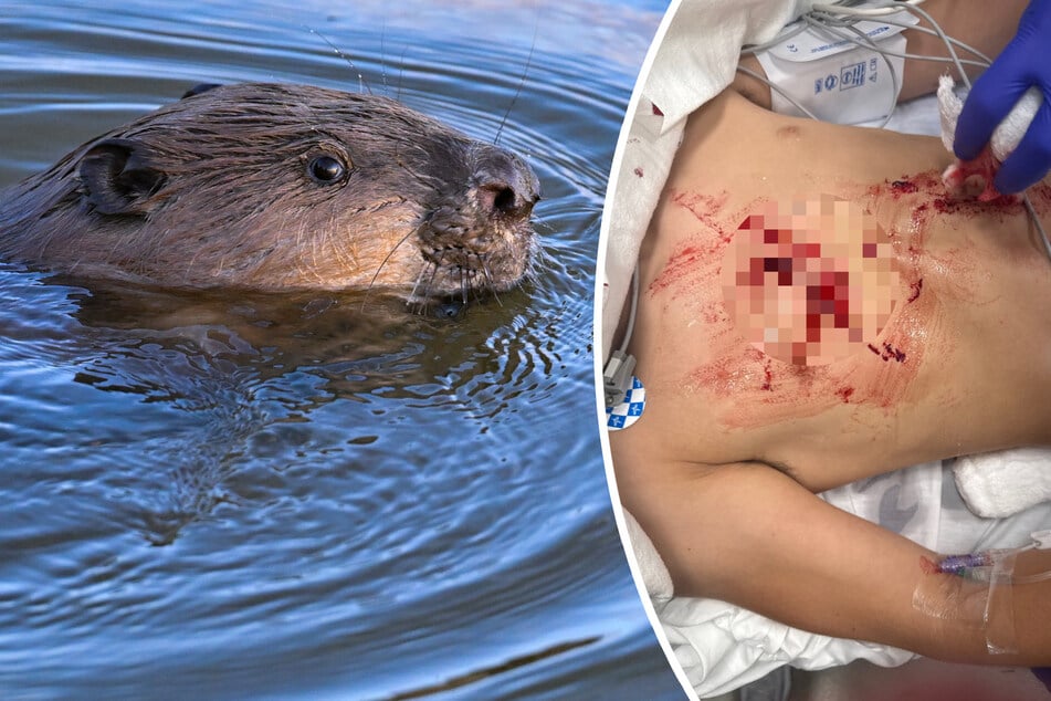 Tiefe Fleischwunden: Tollwut-Biber beißt kleinen Jungen beim Baden