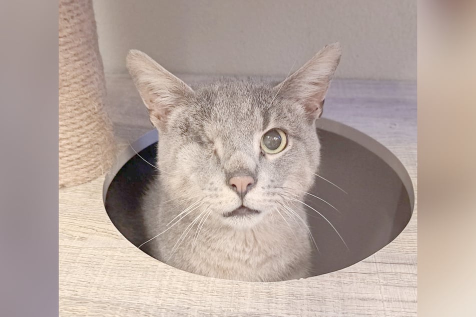 Bei einem Unfall hat er ein Auge verloren.