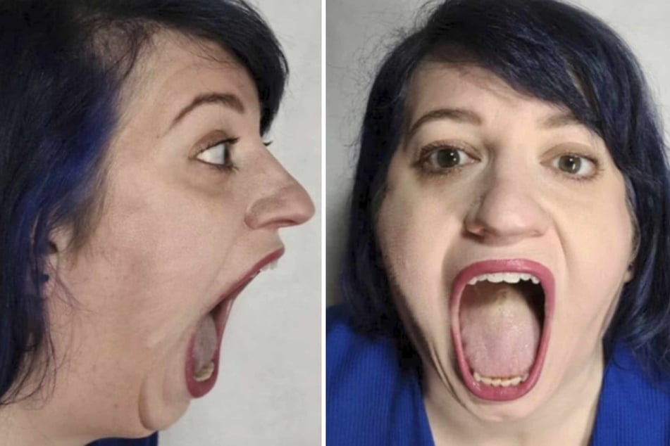 Woman is awarded world record for the "largest mouth gape"