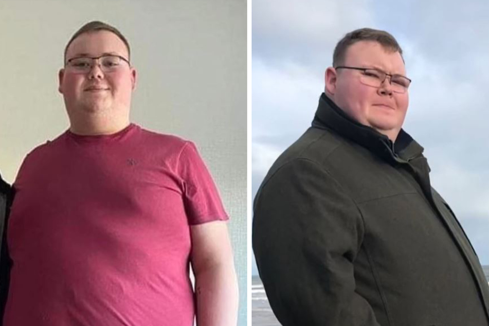 Daniel (23) war einst stark übergewichtig. Dank einer Magenverkleinerung wiegt er inzwischen 110 Kilogramm weniger.