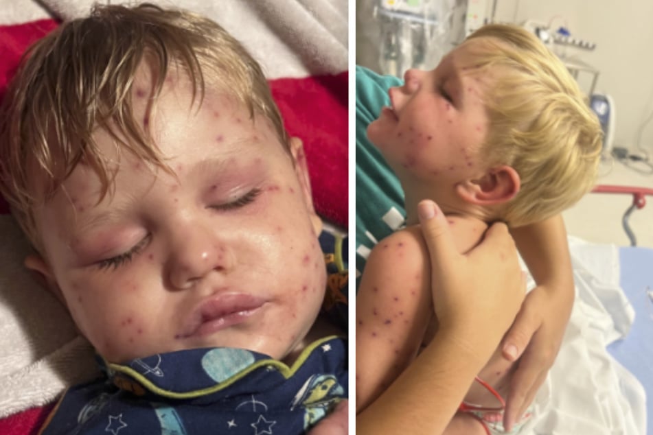 Im Krankenhaus stellten die Ärzte Herz-, Leber- und Nierenversagen bei Beckham fest.