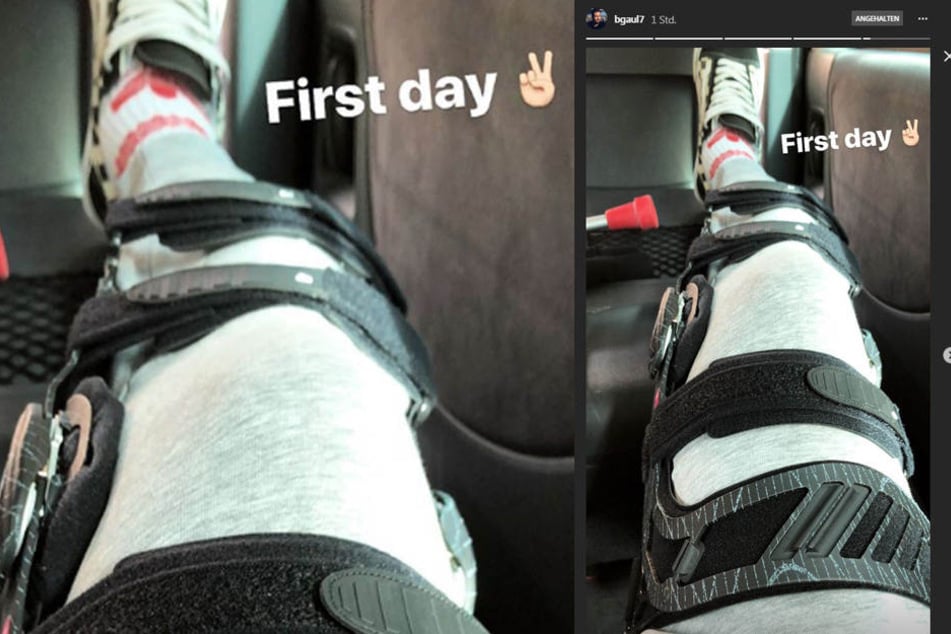In seiner Instagram-Story postete der US-Amerikaner ein Bild seiner Verletzung.