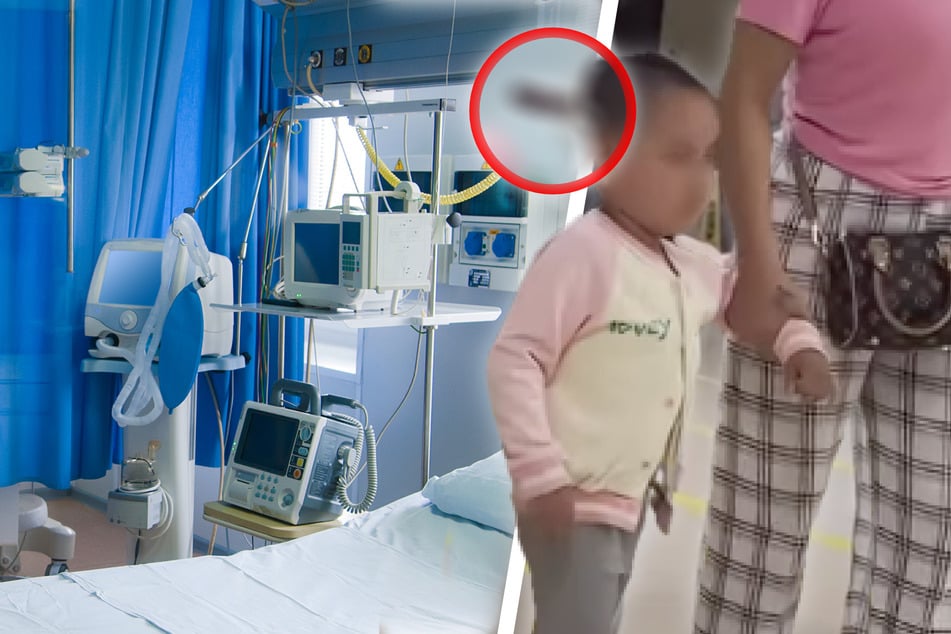 Mutter bringt Tochter (3) ins Krankenhaus: Was Ärzte im Kopf entdecken, ist unfassbar