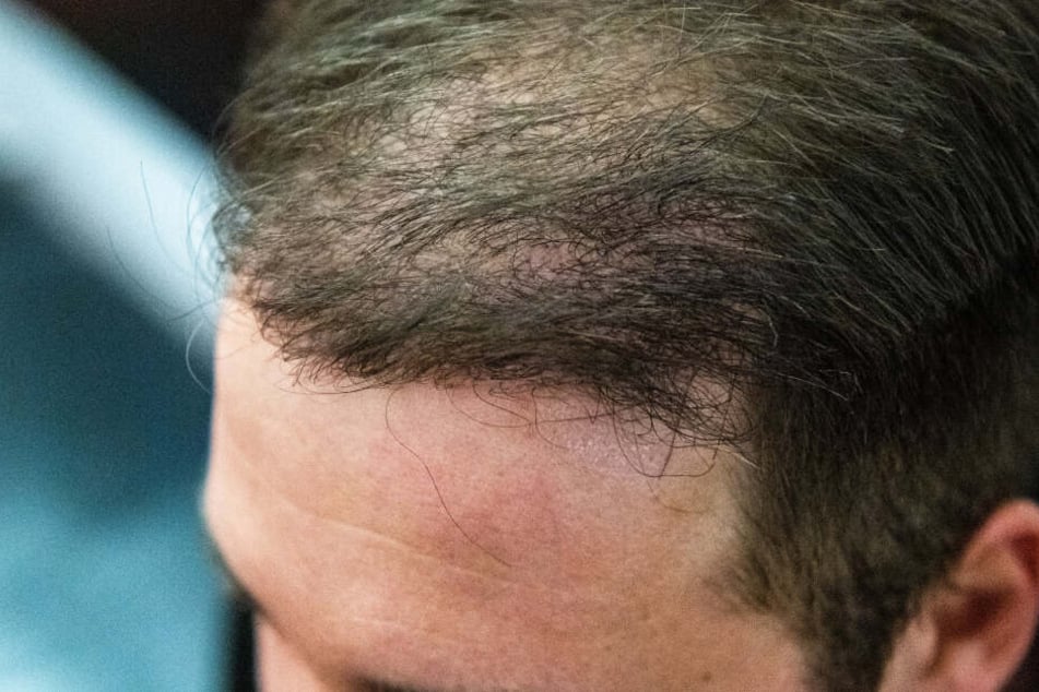 Der Kläger im Prozess um eine schmerzhafte Haartransplantation sitzt auf einer Bank im Oberlandesgericht und zeigt die Stelle an der ihm Haare transplantiert wurden.