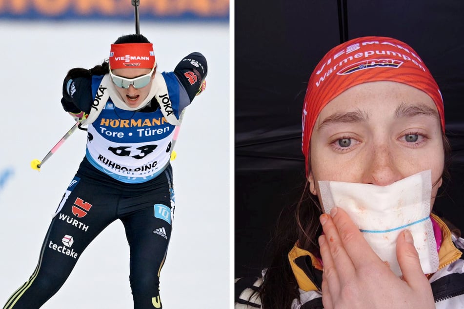 Deutsche Biathletin packt über Horror-Unfall aus: Sie brauchte eine Zungen-Transplantation!