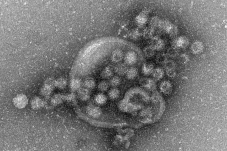 Der Norovirus löst unter anderem Erbrechen, Übelkeit, Bauchkrämpfen und Fieber aus.