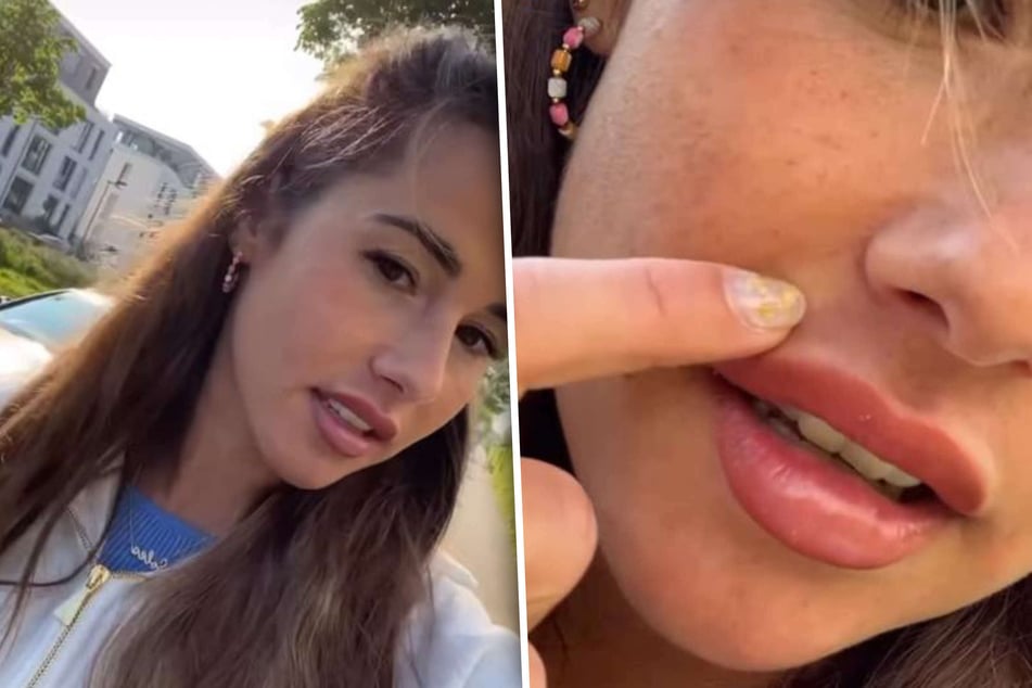 Sarah Engels (29) bat ihre Instagram-Fans am Mittwoch um Tipps. Seit der Schwangerschaft kämpft die Sängerin mit einem kosmetischen Problem.