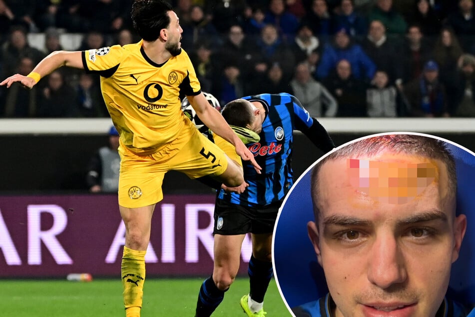 In dieser Szene bekommt Nikola Krstović (25, r.) die Stollen von Dortmunds Ramy Bensebaini (30, l.) ins Gesicht. Das Foul führte zum spielentscheidenden Elfmeter.