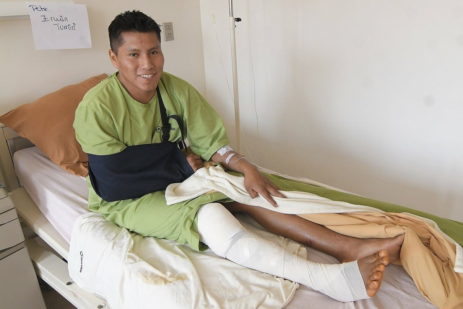 Erwin Tumiri poses as he recovers from the injuries he suffered in the serious bus crash.