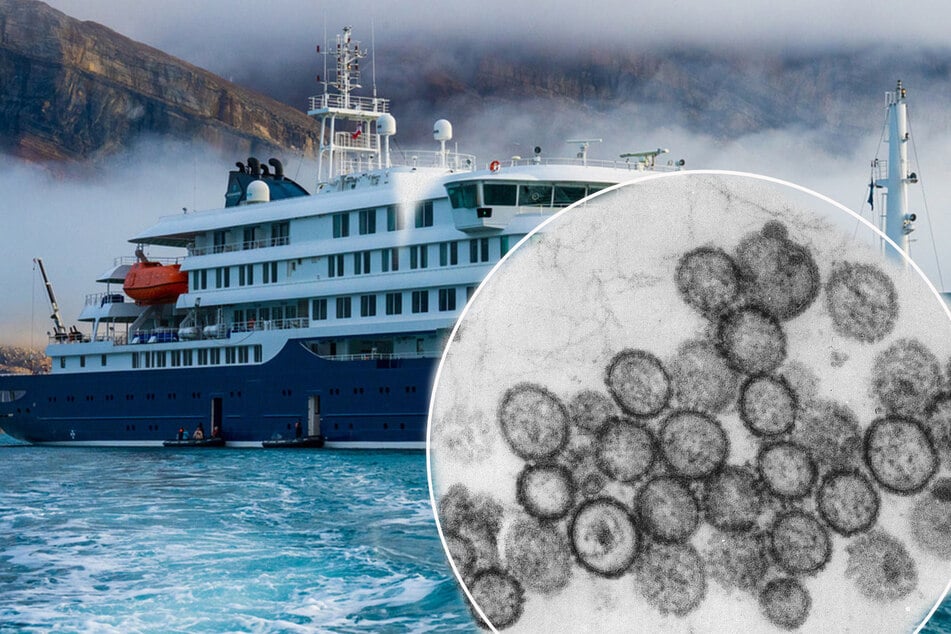 Hantavirus: Wie hoch ist die Gefahr einer Infektion in Deutschland?
