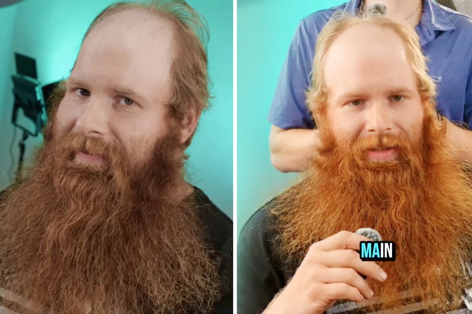Barber Grant musste bei seinem Kunden (31) eine schwierige Entscheidung treffen: Kaschieren oder Glatze?