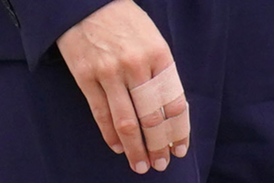 Zwei Finger von Prinzessin Kate waren mit Pflaster getapt.