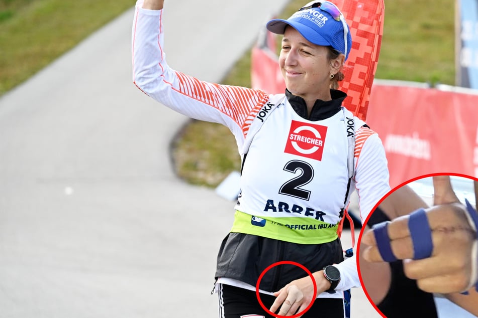 OP-Schock in der Olympia-Saison: Biathlon-Star Franziska Preuß zeigt riesige Narbe
