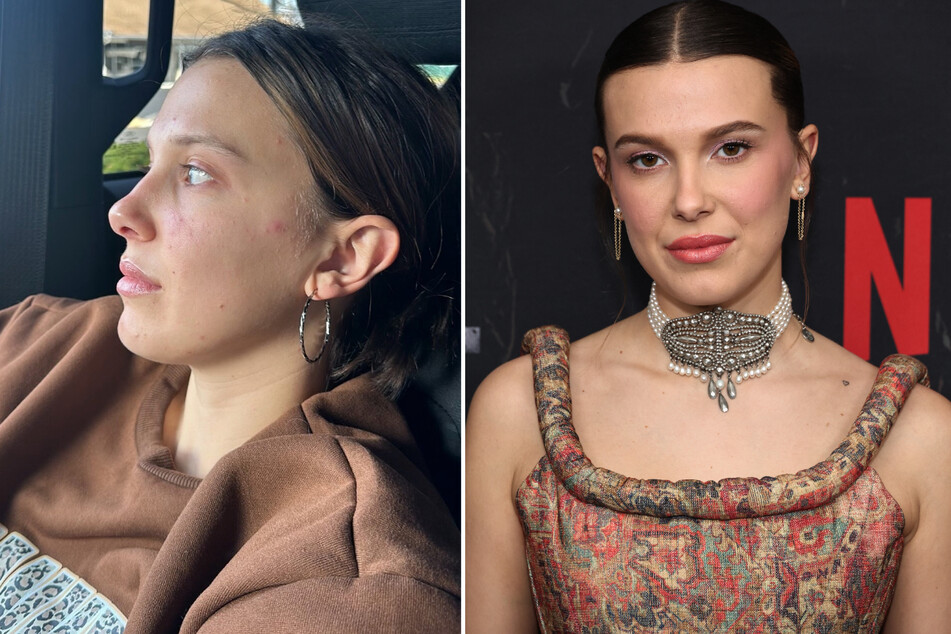 Millie Bobby Brown shared a vulnerable message about her struggle with acne alongside a makeup-free selfie.