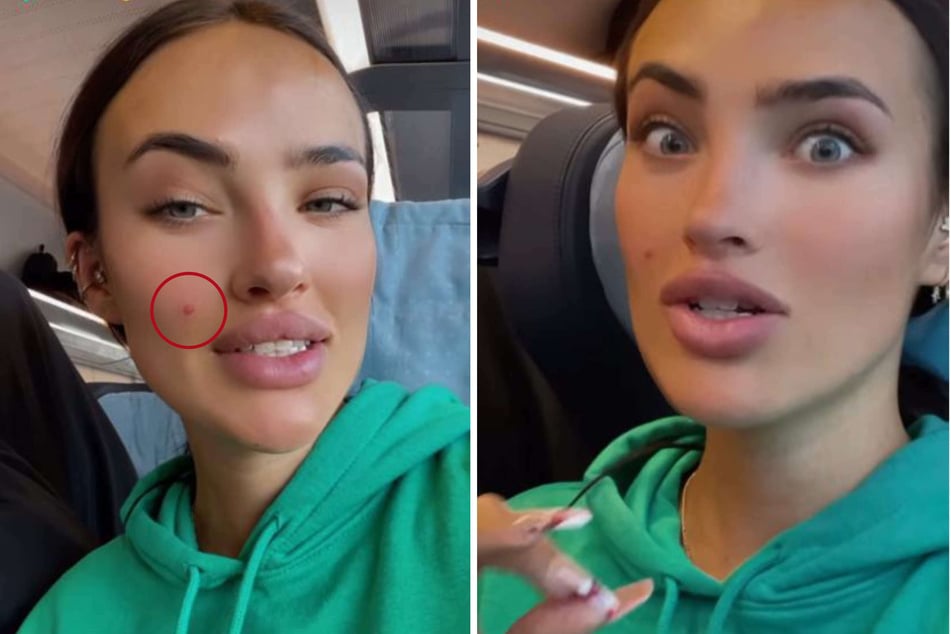 Paulina Ljubas (25) zeigte sich jüngst in ihrer Instagram-Story mit einem Pickel im Gesicht.