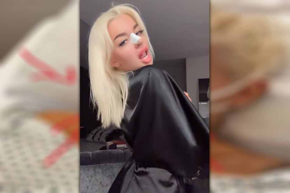Rapperin Katja Krasavice (30) hat sich erneut die Nase operieren lassen. Wie sie nun gestand, war der Eingriff offenbar mehr als notwendig.