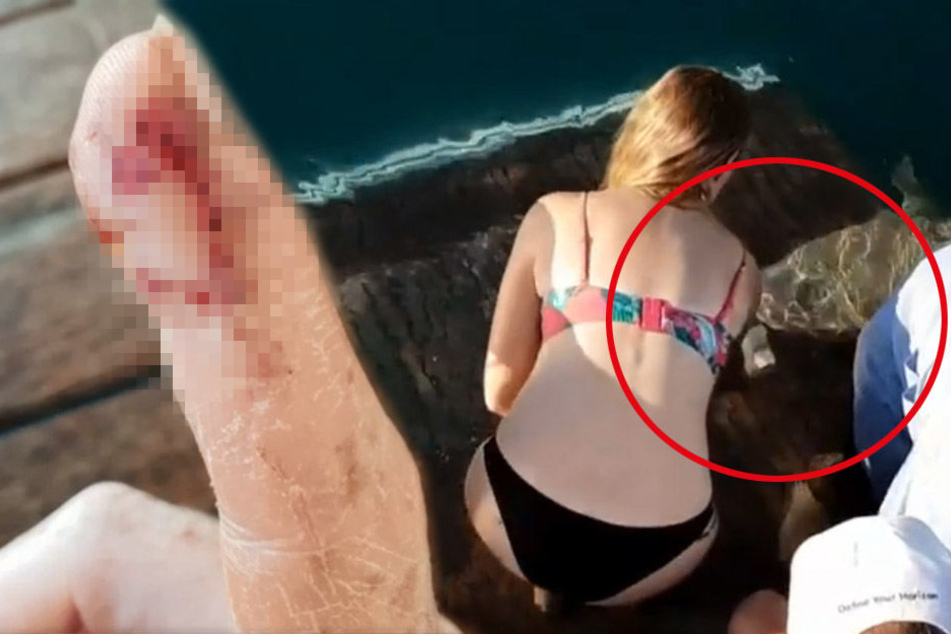 Melissa Brunning kam dem Hai beim Füttern etwas zu nahe und wurde ins Wasser gezogen. Zum Glück kam sie mit dem Schrecken und einem demolierten Finger davon.