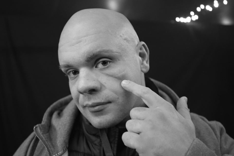 Christian Oheim zeigt seine Narben.