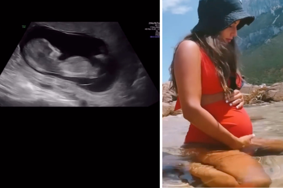 Warten auf das Baby: Sarah Engels zeigt Ultraschall-Aufnahmen