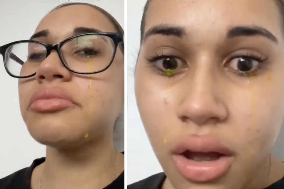 Pipi in den Augen? Frau weint gelbe Tränen - Video geht viral