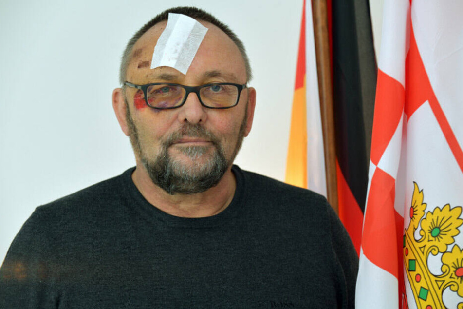 Frank Magnits zeigt sich nach der Attacke im Bremer AfD-Büro.