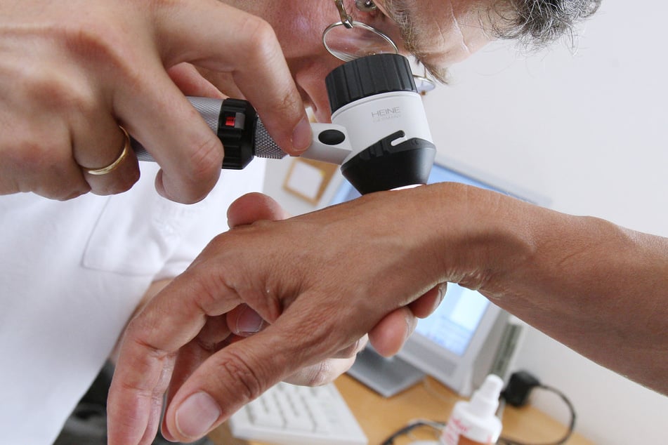 Viele Krankenkassen bieten ab 35 Jahren ein kostenloses Hautkrebs-Screening an. (Archiv)