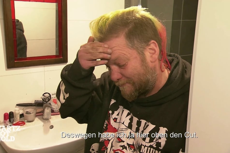 Kumpel Gollum (41) zeigt, wo ihn Paddy letztens verletzt hat.