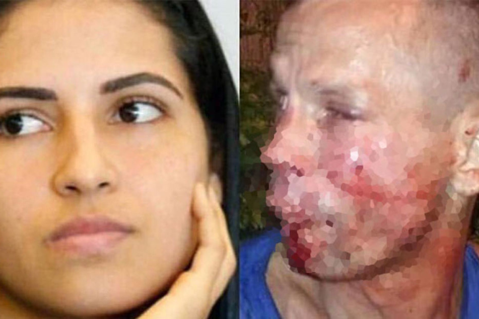 Die UFC-Kämpferin Polyana Viana und der übel zugerichtete Dieb.