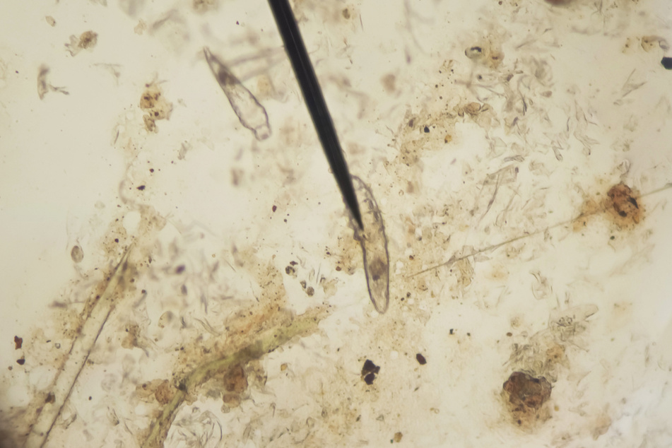 Zwei Demodexmilben unter dem Mikroskop.