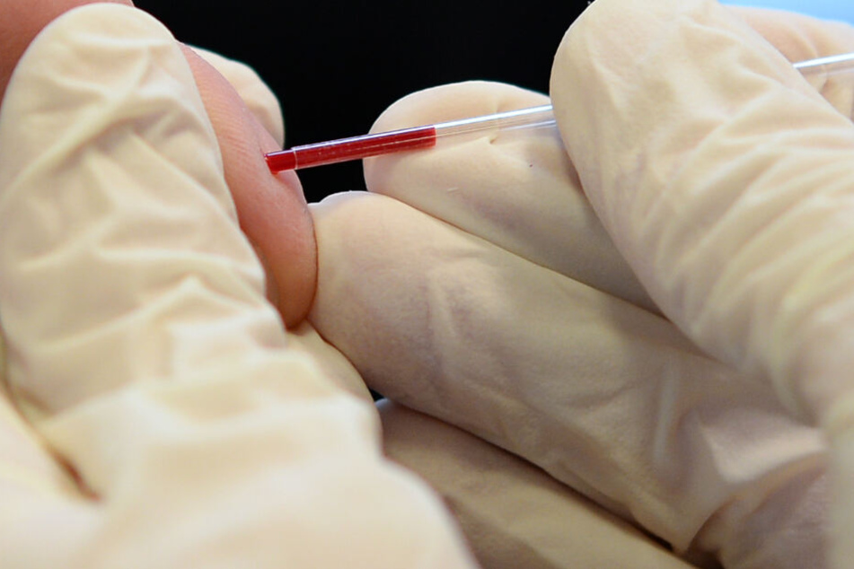 91 Prozent aller HIV-Infektionen werden in Baden-Württemberg laut RKI diagnostiziert, davon 93 Prozent therapiert, davon wiederum 95 Prozent mit Erfolg.