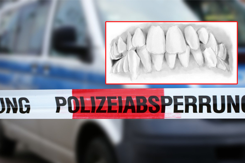 Das Gebiss der unbekannten Toten ist ein wichtiger Anhaltspunkt für die Kriminalpolizei in Mainz.