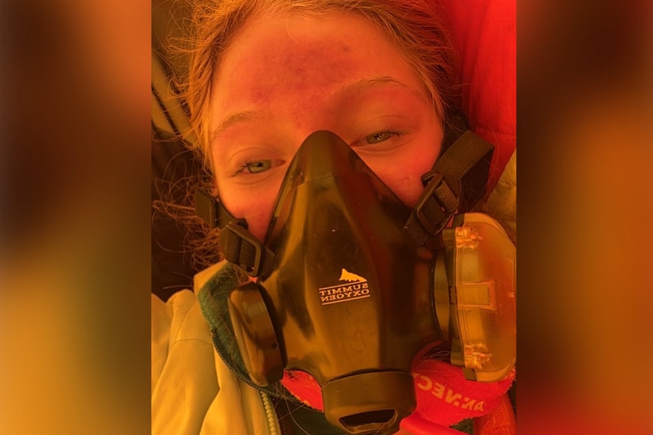Die Besteigung des Mount Everest hat Bianca ordentlich zugesetzt.