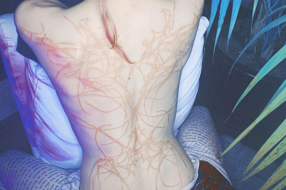 Elon Musk's girlfriend Grimes gets extreme scarification body mod on her back