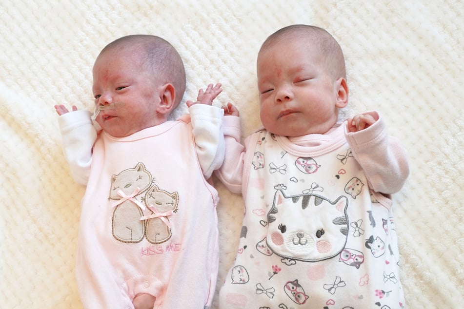 Wie süß: Die Zwillinge Jasmin Malisa und Emily Lalisa kamen Mitte Juli im Chemnitzer Klinikum zur Welt.