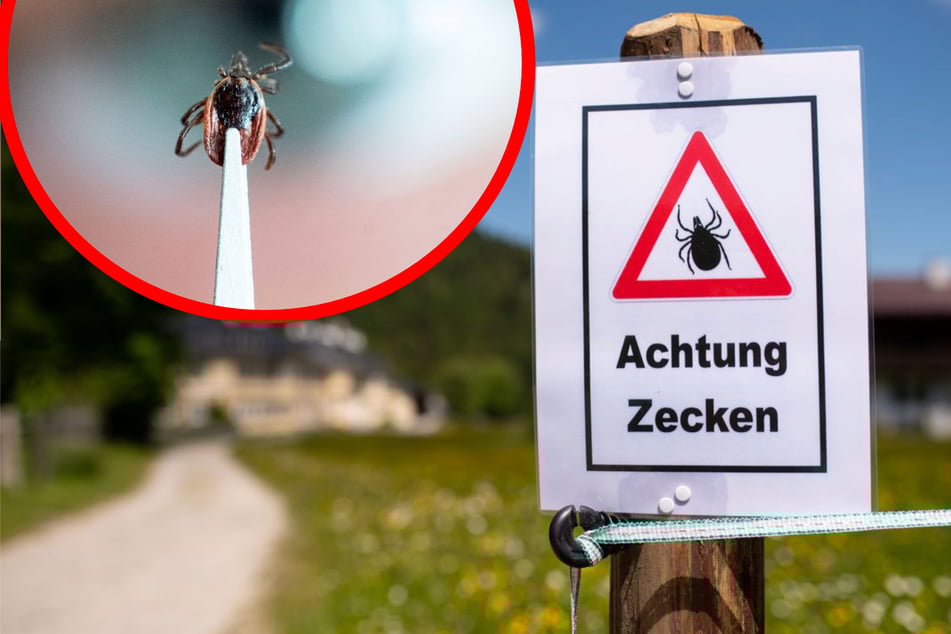 Risiko für Hirnhautentzündung "dramatisch erhöht": Mehr Zecken durch Klimakrise?