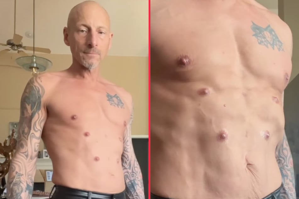 Tattooed man gets four new nipples in radical body modification