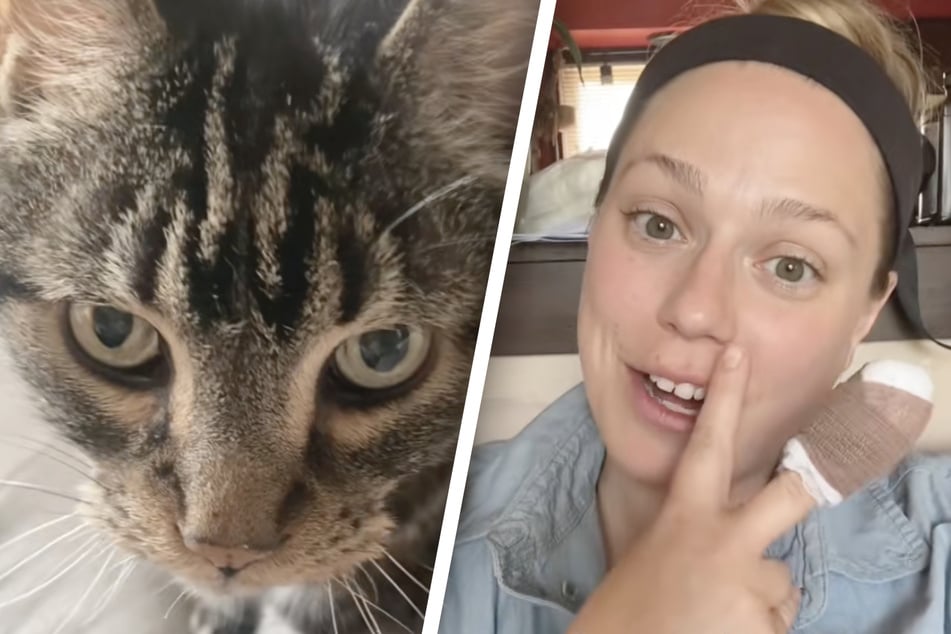 Von eigener Katze verletzt - was danach geschieht, hätte Besitzerin nie erwartet