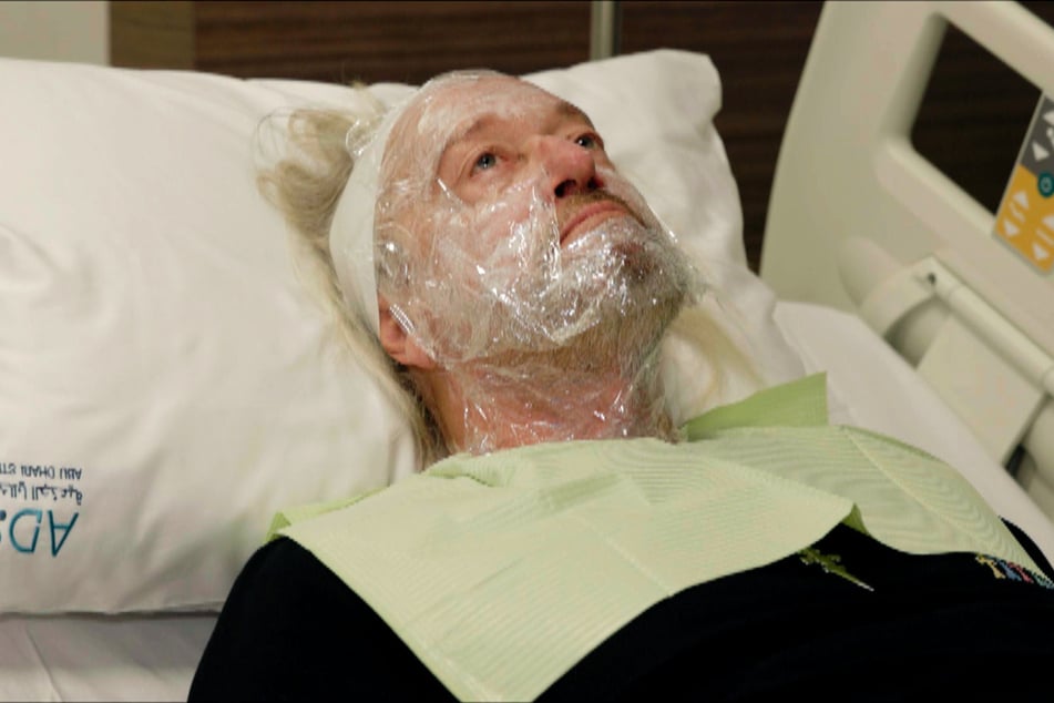 Auch Robert Geiss (62) möchte dem Alterungsprozess in seinem Gesicht und auf seinem Kopf entgegenwirken.