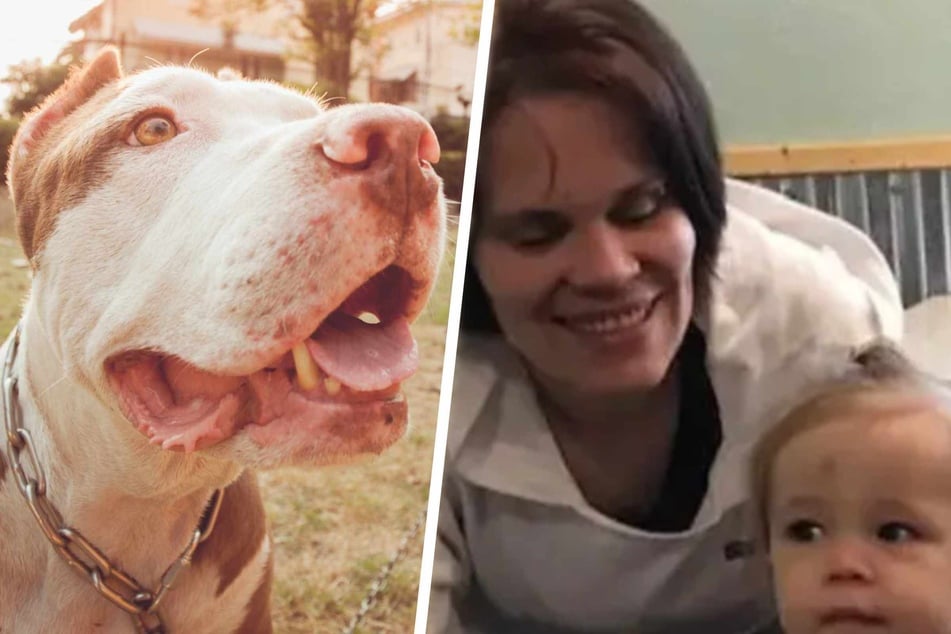 Drei Pitbulls stürzen sich auf Mutter: Körperteile fehlen, Gesichts-Rekonstruktion nötig