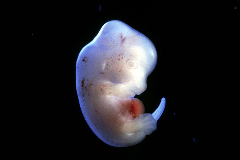 Japanische Forscher dürfen mit der Züchtung von menschlichen Organen in Tieren beginnen, etwa so wie bei diesem Rattenembryo.