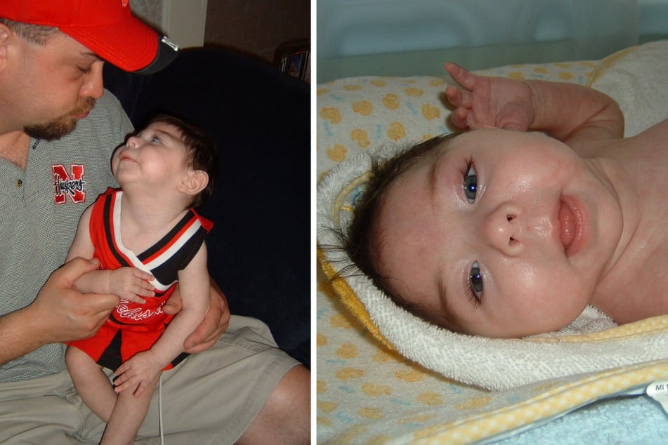 La estadounidense nació con una enfermedad rara llamada hidranencefalia.