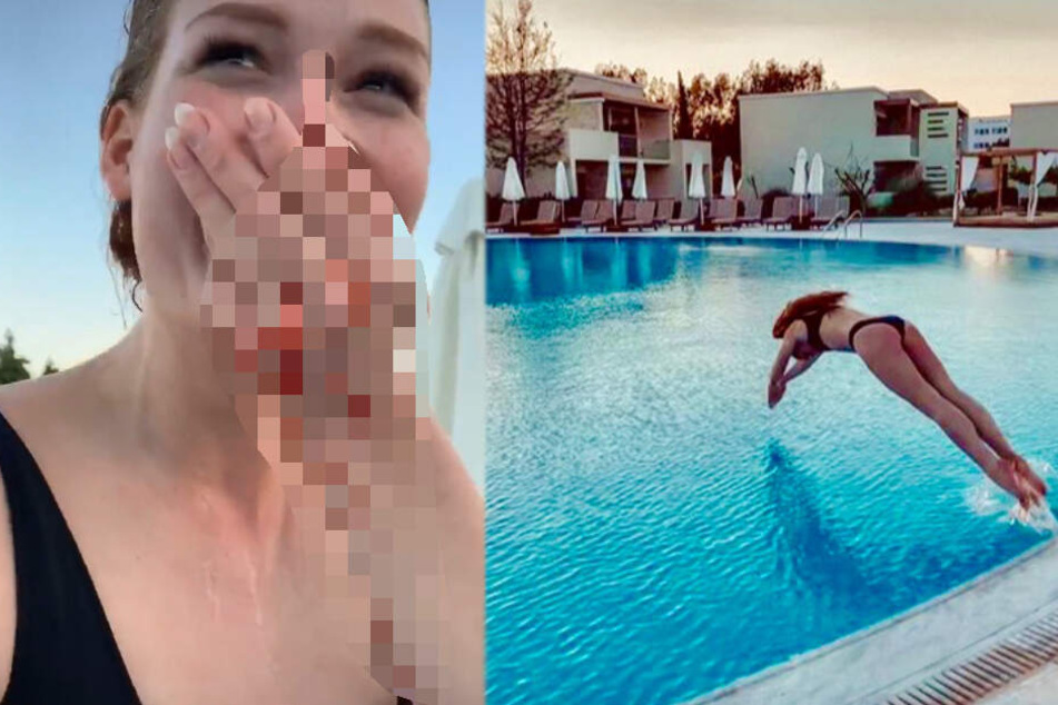 GNTM: Ex-GNTM-Kandidatin will sexy Pool-Foto schießen, dann passiert blutiges Unglück