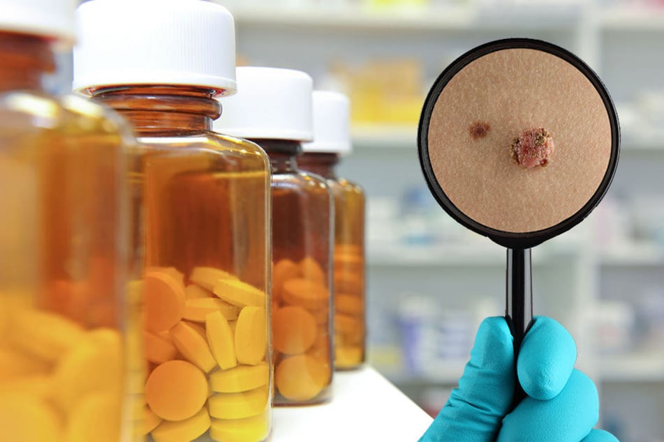 Männer müssen bei der Aspirin-Einnahme vorsichtig sein - sonst droht Hautkrebs.