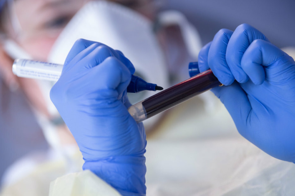 An employee of the Robert Koch Institute (RKI) labels a blood sample for an antibody test.