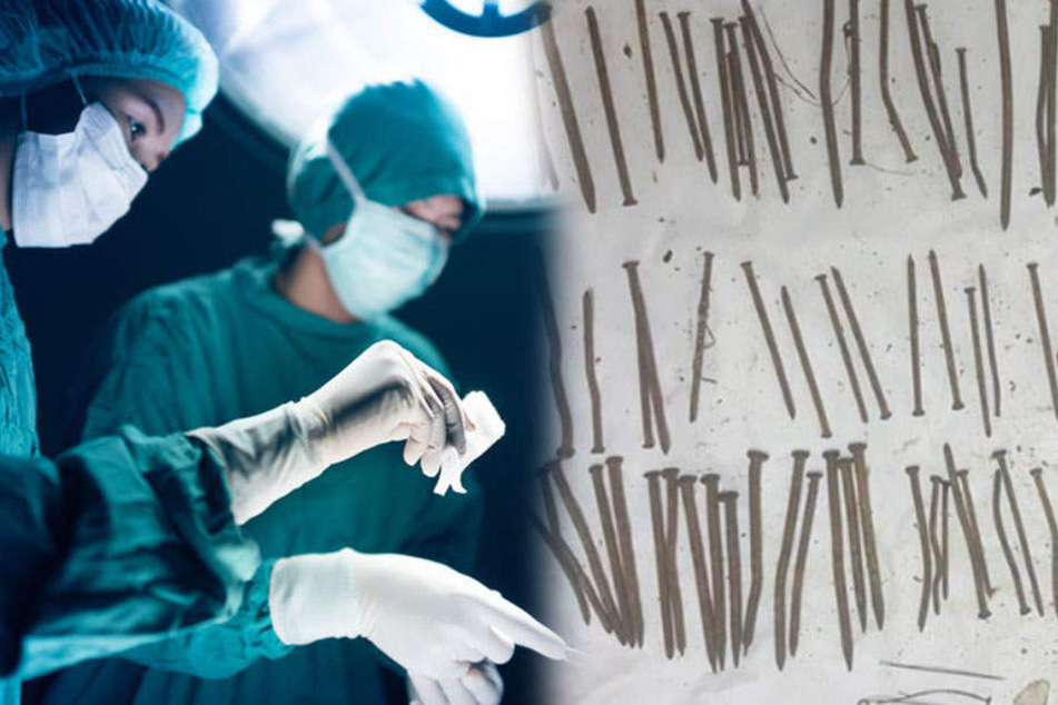 Ärzte machen im Magen eines Mannes unglaubliche Entdeckung